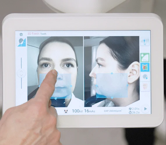 Effortless patient positioning