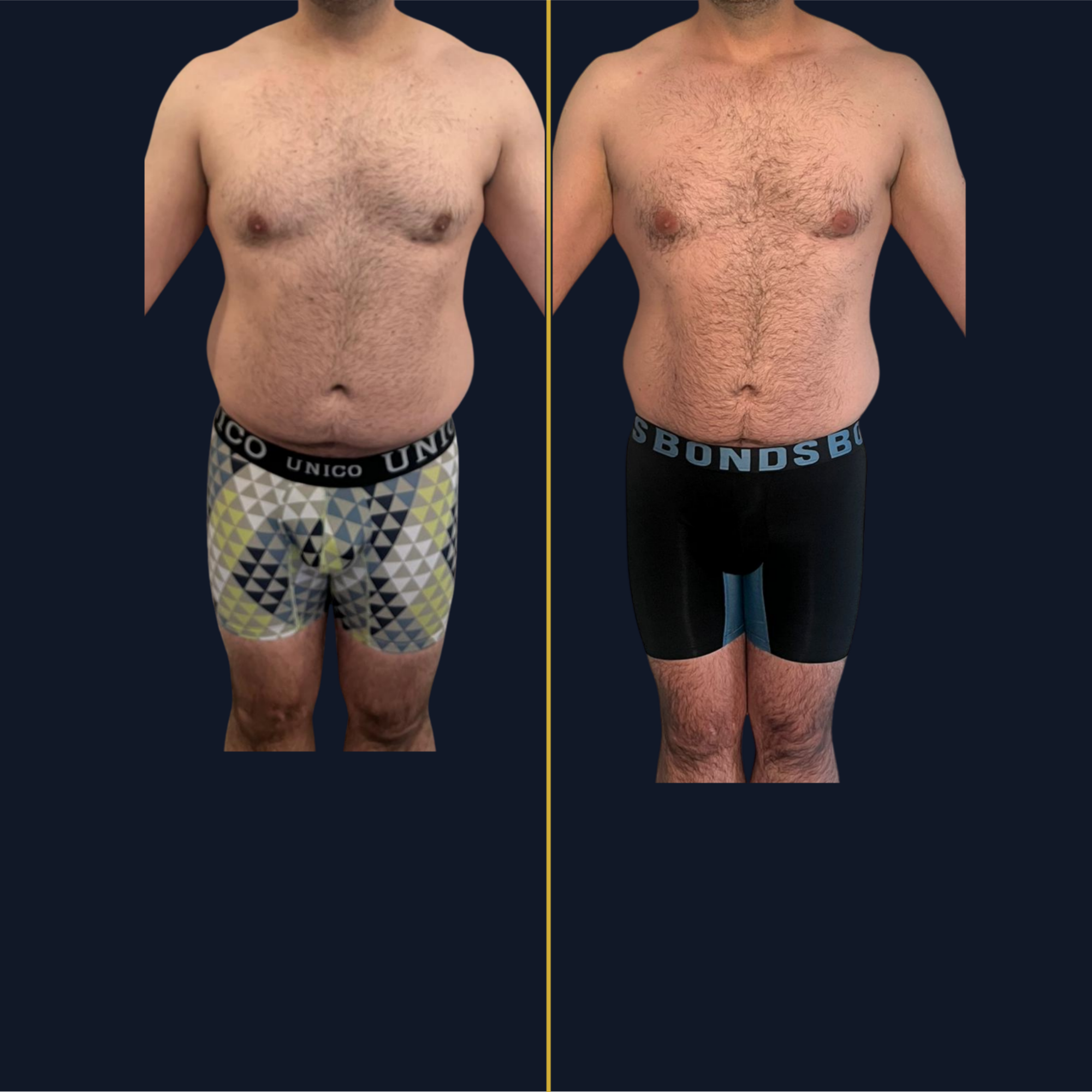 Transformación de Camilo