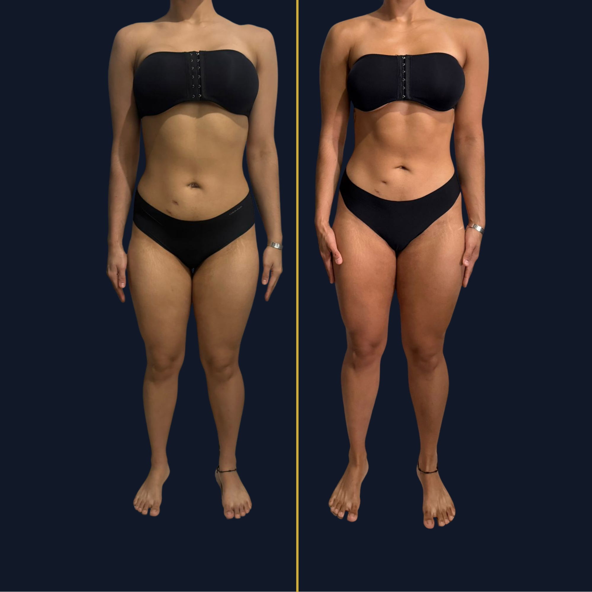 Transformación de Dafne