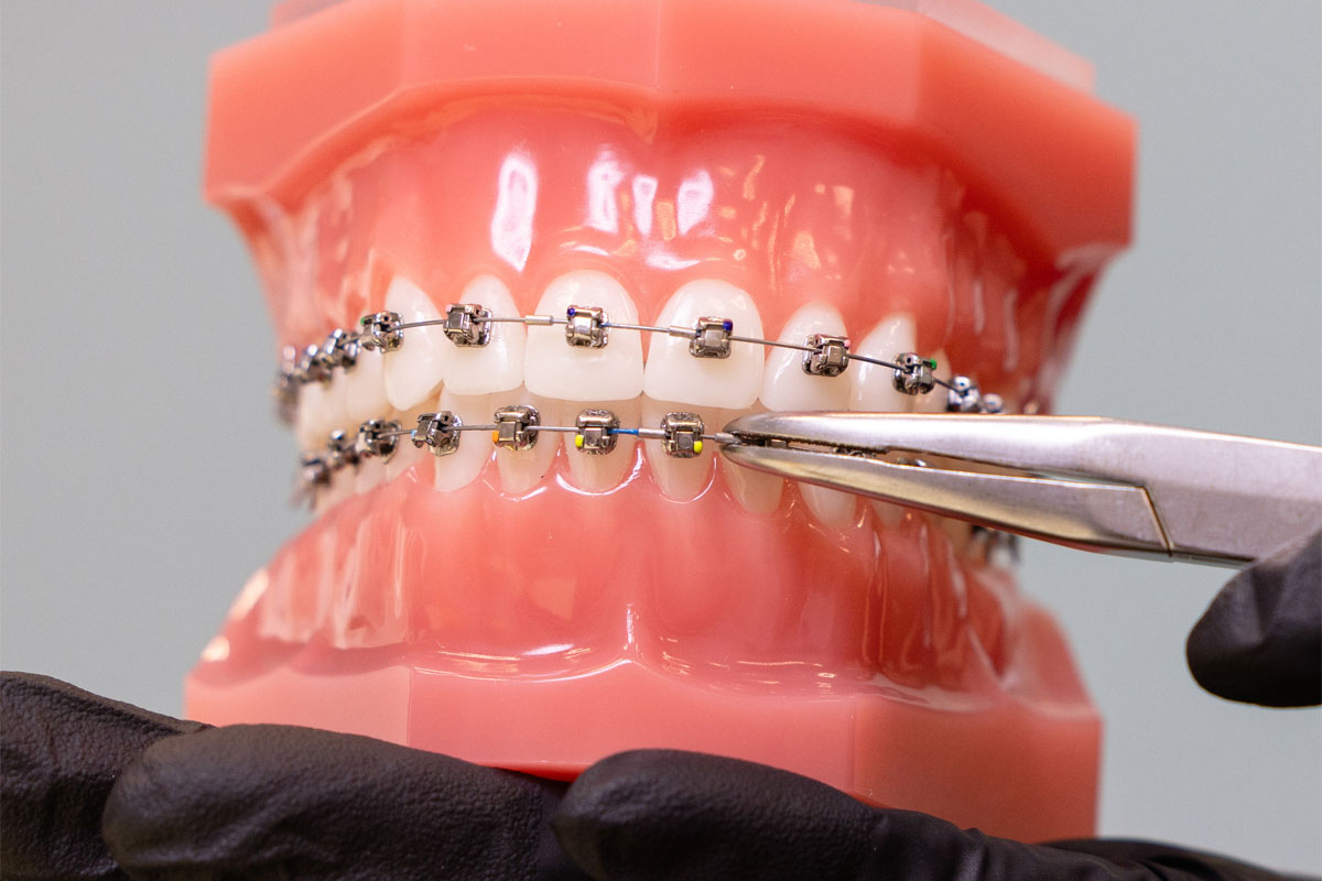 Productos de Ortodoncia