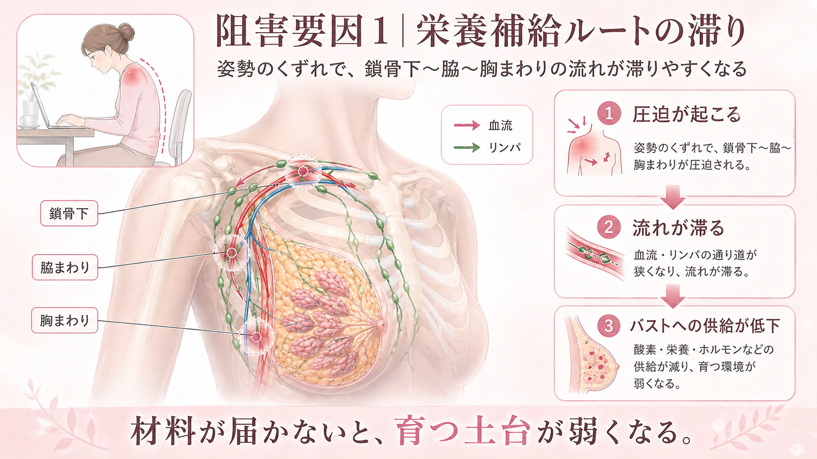 栄養補給ルートの解剖図(鎖骨下→脇→胸郭→バスト)