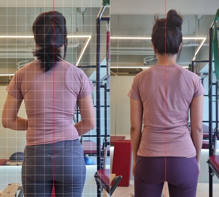 목 스트레칭 실습