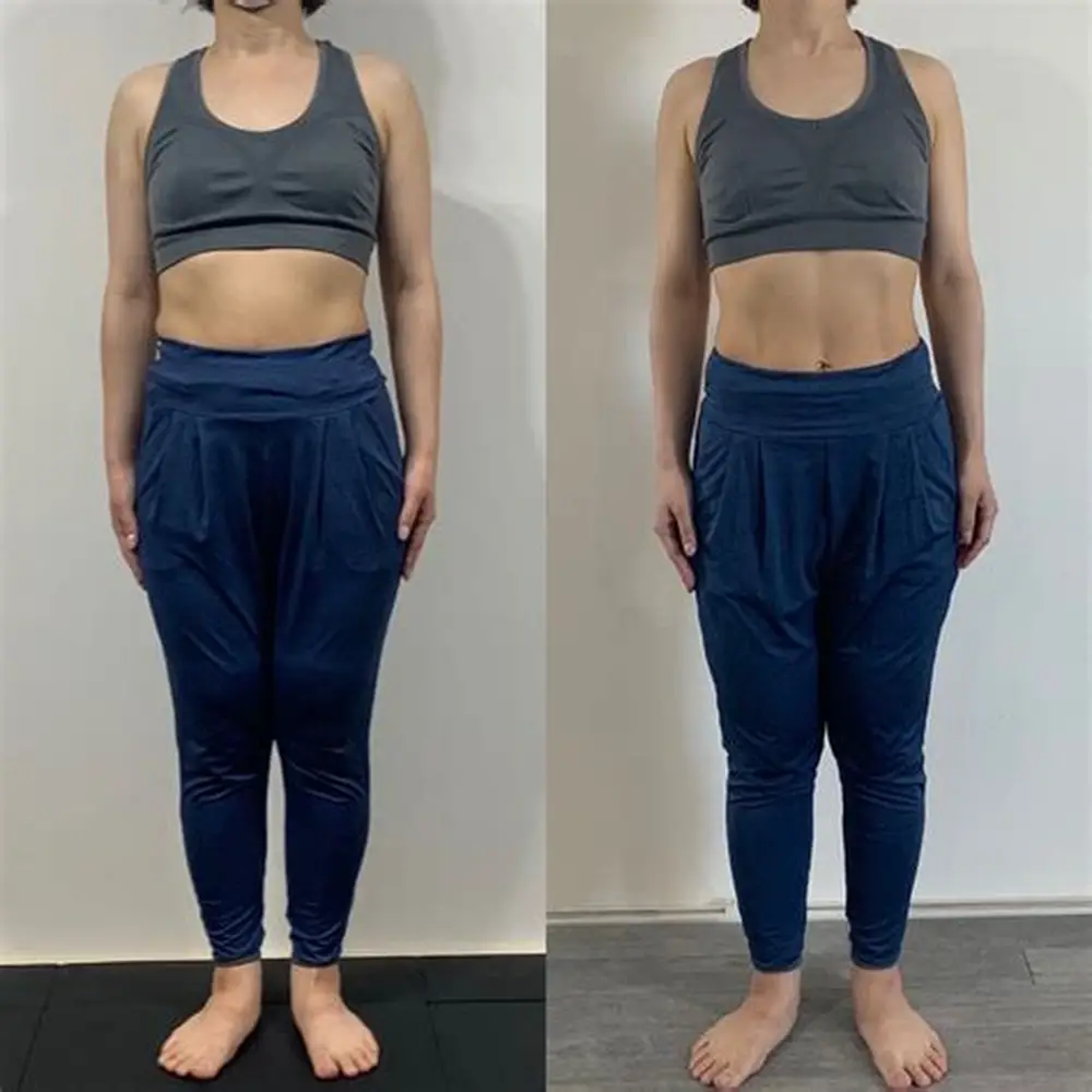 M.T.さんさんのBefore After写真