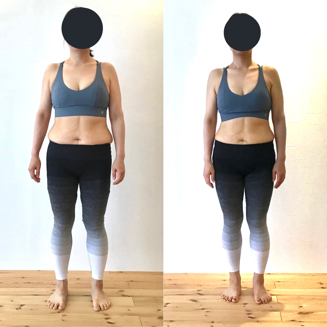 K.Y.さんさんのBefore After写真