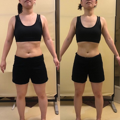 Y.S.さんさんのBefore After写真