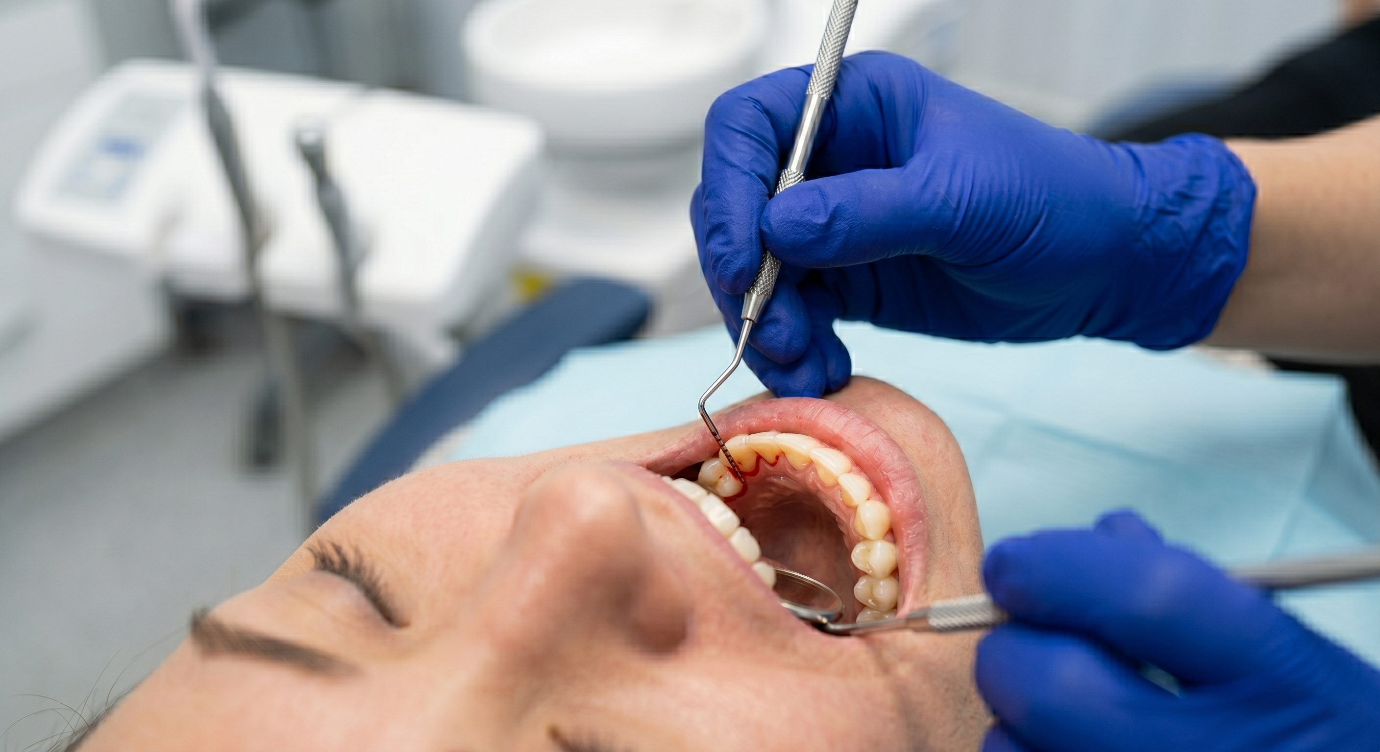 お口の現状を数値化