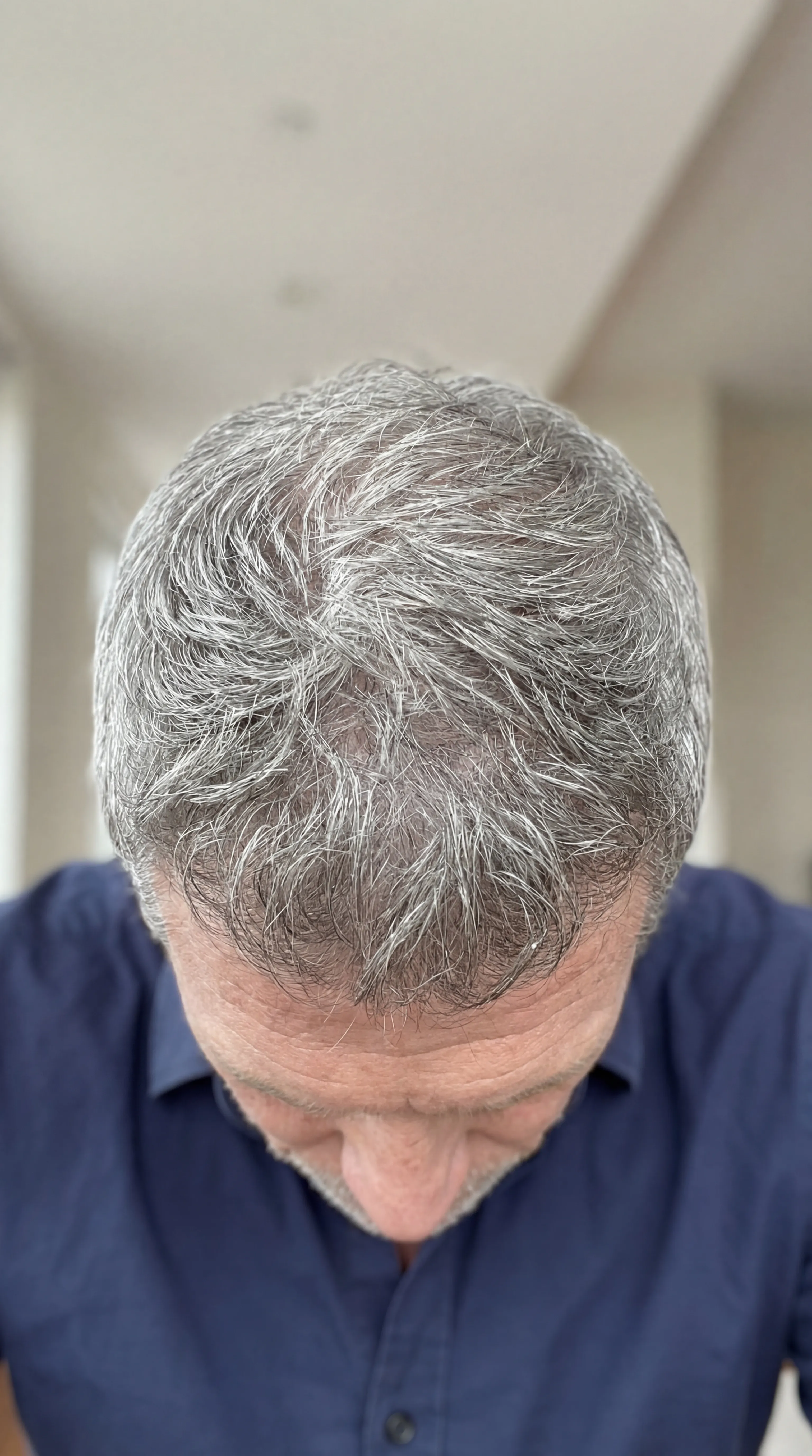 Mason after hair regrowth