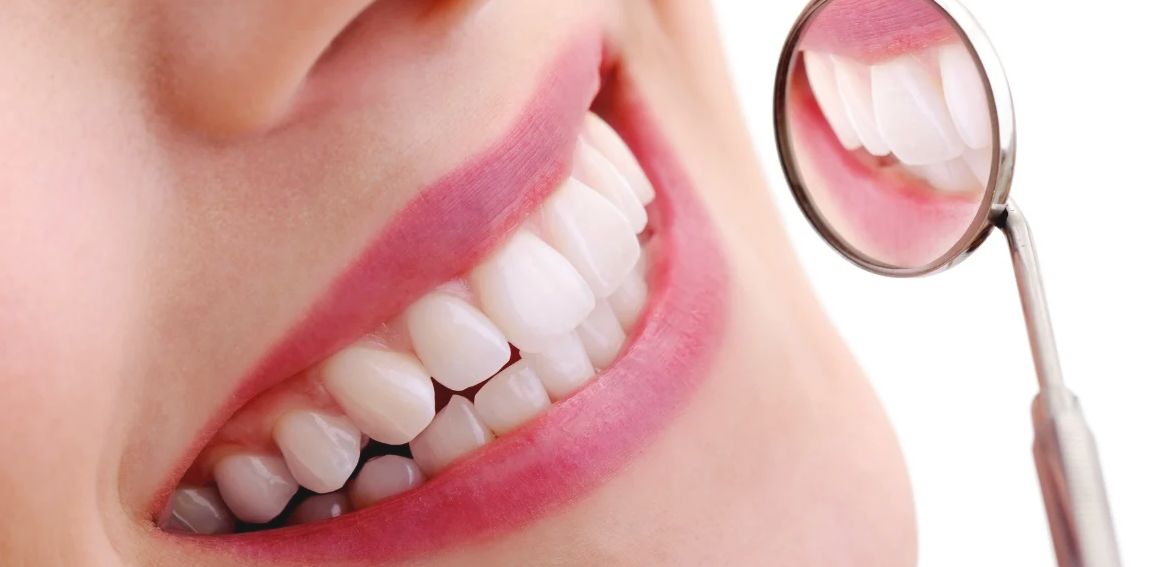 Sorriso perfeito com facetas dentárias