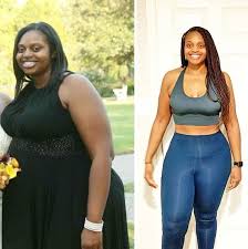 Transformación real antes y después - Cliente satisfecha con aceite de jengibre