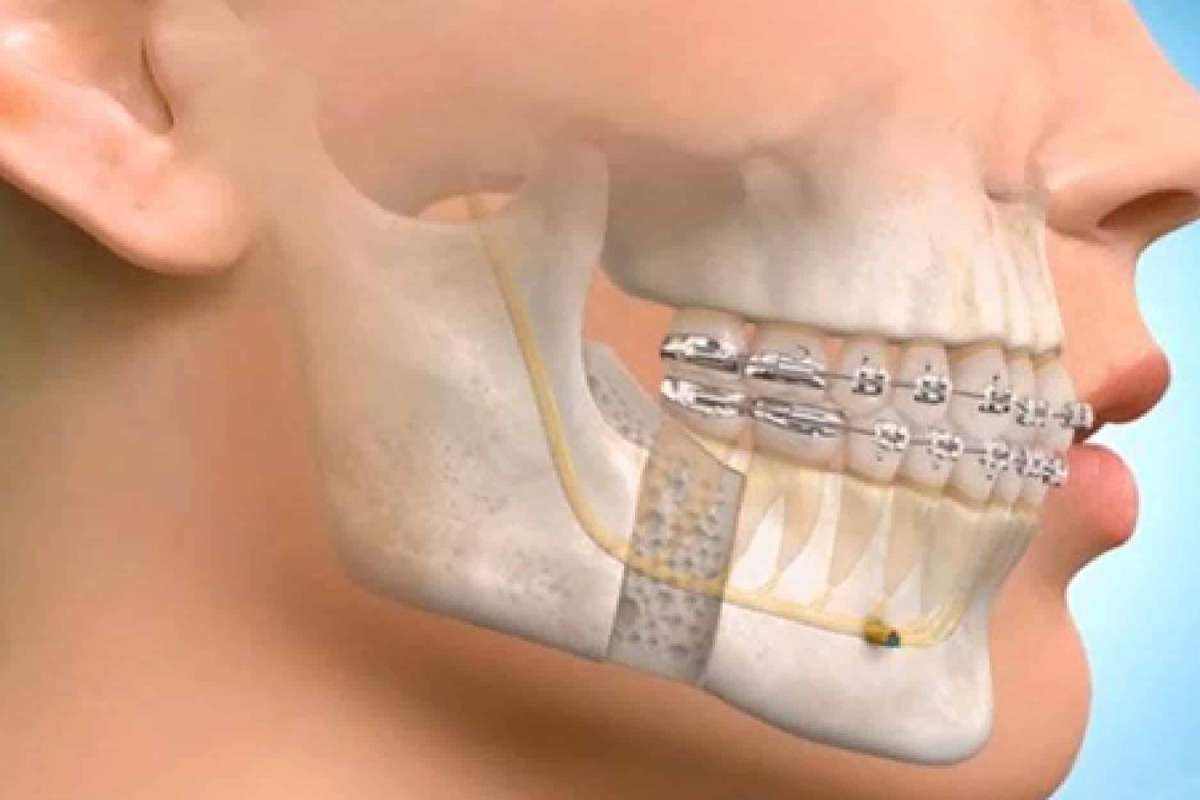 Oral & Maxillofacial Surgery