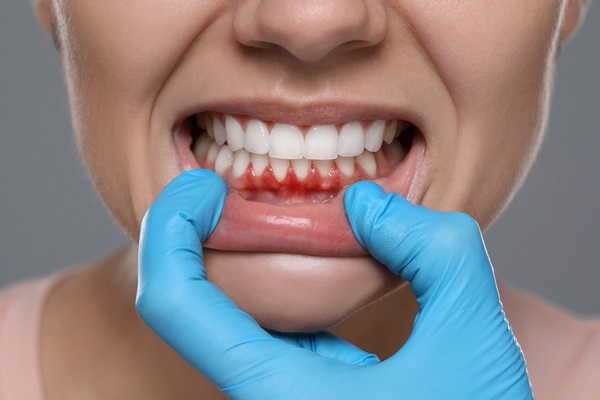 Periodontics