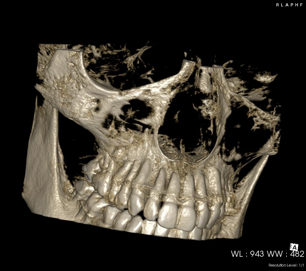 最新の3D-CT診断
