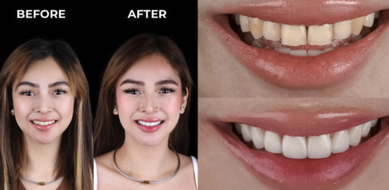 Cillo Smile Design clinic 2