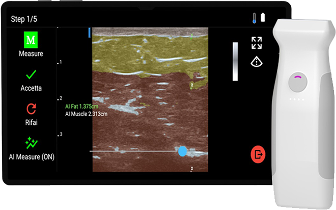 UltraComp One - Analizzatore composizione corporea con ultrasuoni e AI