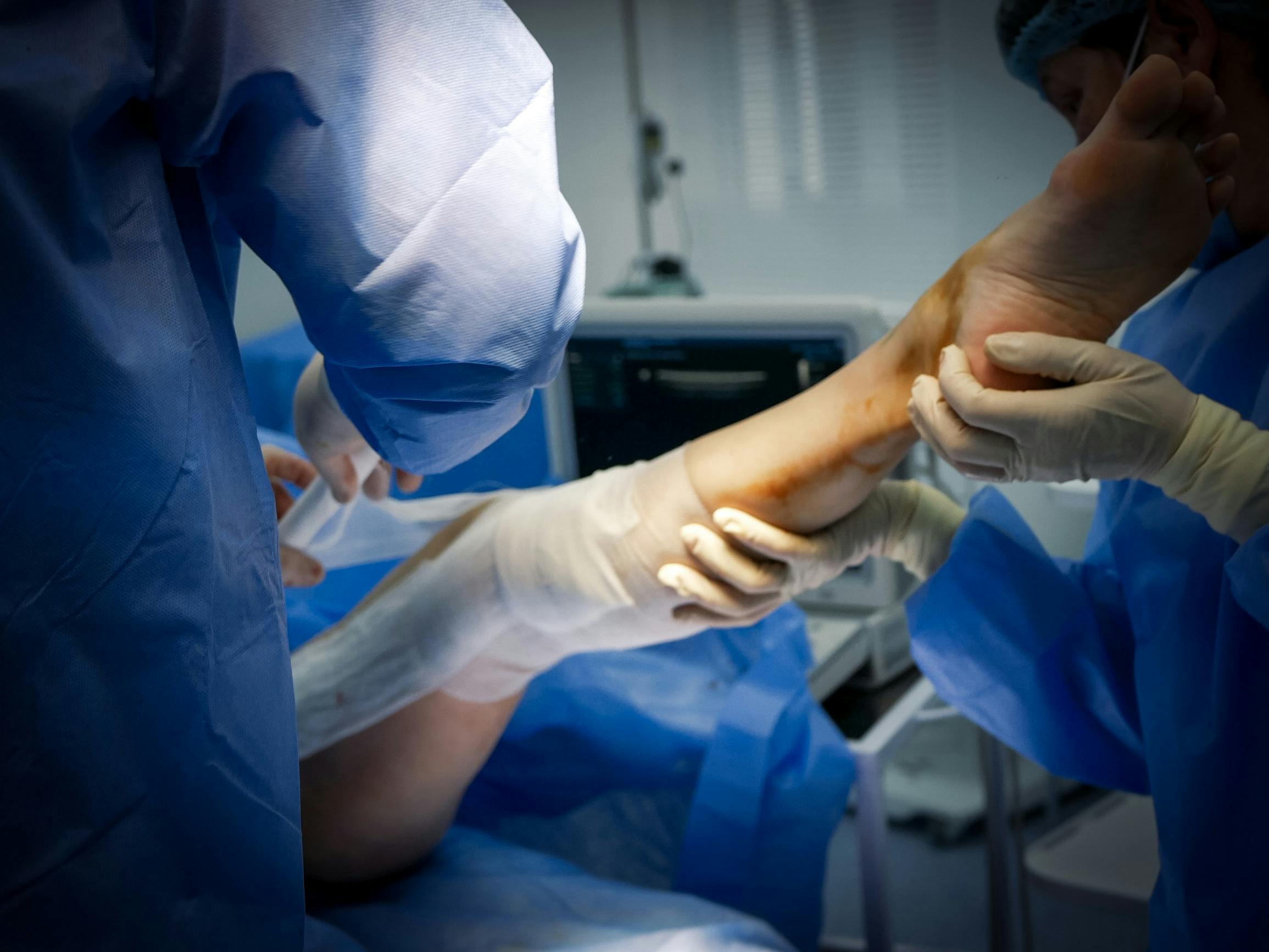 Foot & Leg Wounds