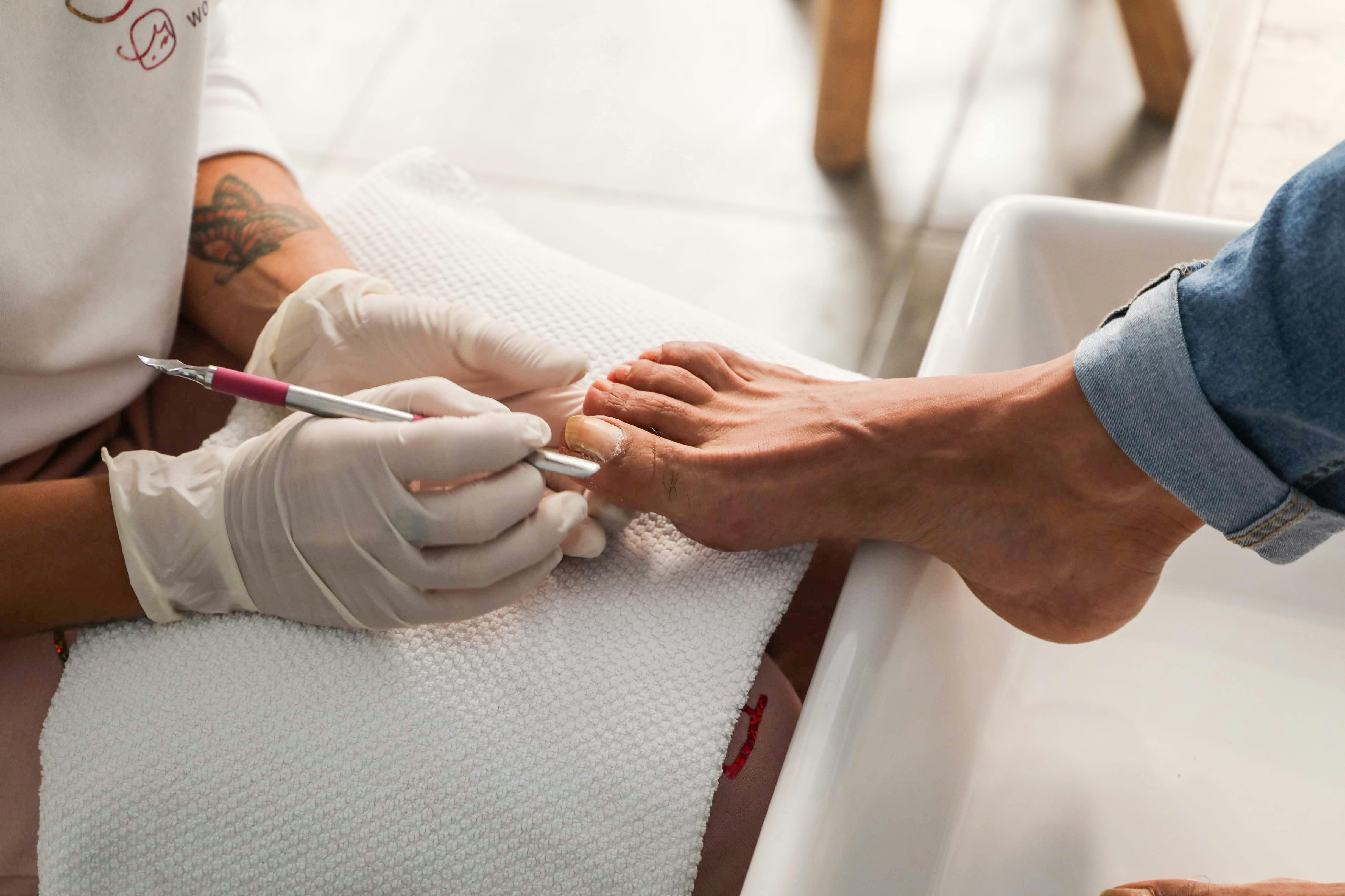 Fungal Nail Care