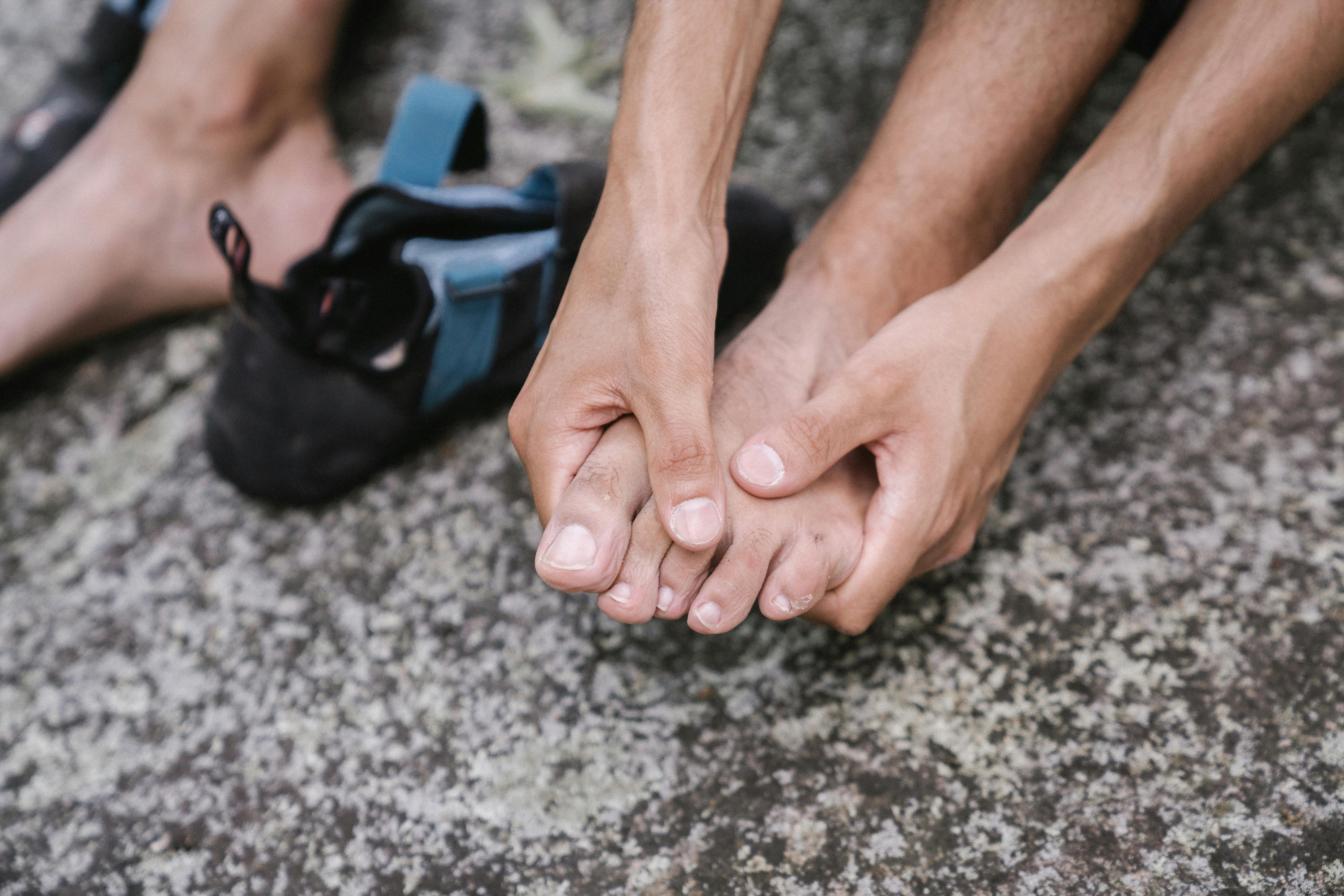 Hammertoes