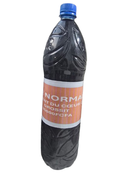 Hypertrophie du Cœur – Cardiomégalie & Myocardiopathie