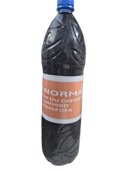 Hypertrophie du Cœur – Cardiomégalie & Myocardiopathie