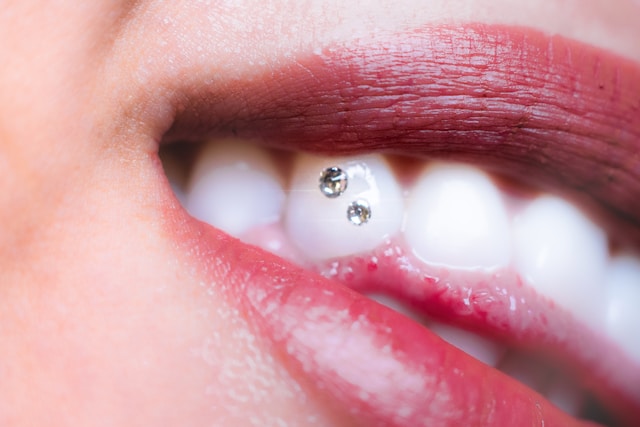 Strass dentaire bijou de dent — Nelia Beauty La Réunion