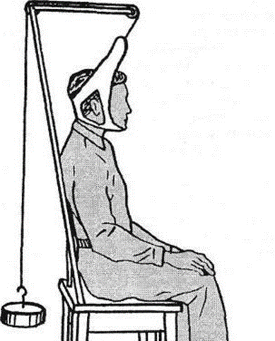 グリソンの輪|17世紀の頸椎牽引装置・首こり治療器具の歴史的図解