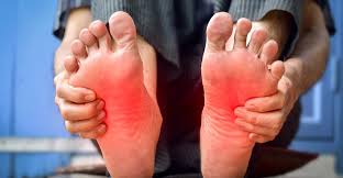 Person showing neuropathy symptoms