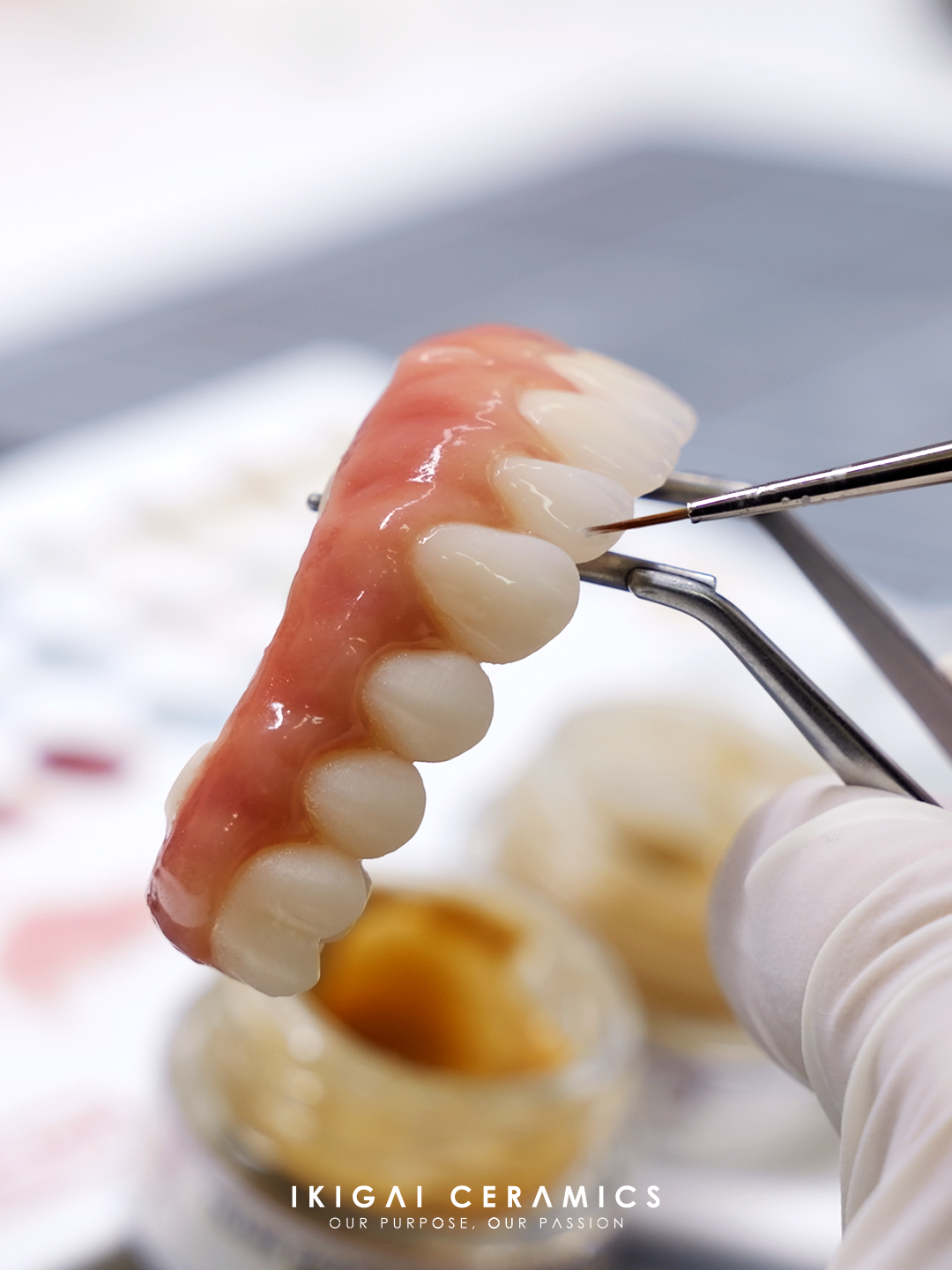 Full Arch Zirconia Restoration