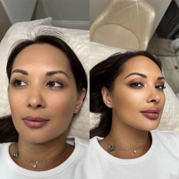 Уход и забота