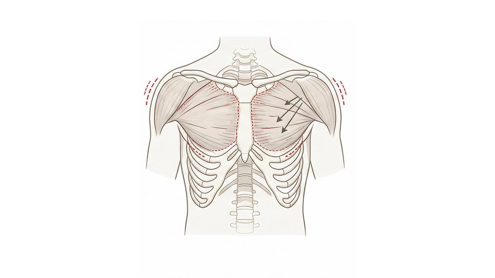 Si formano rigidità anteriori