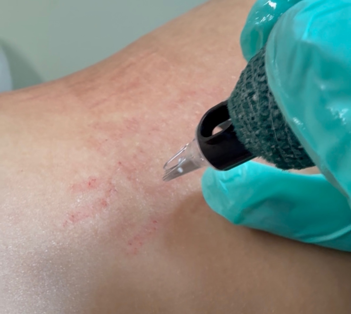 Camuflaje de Estrías