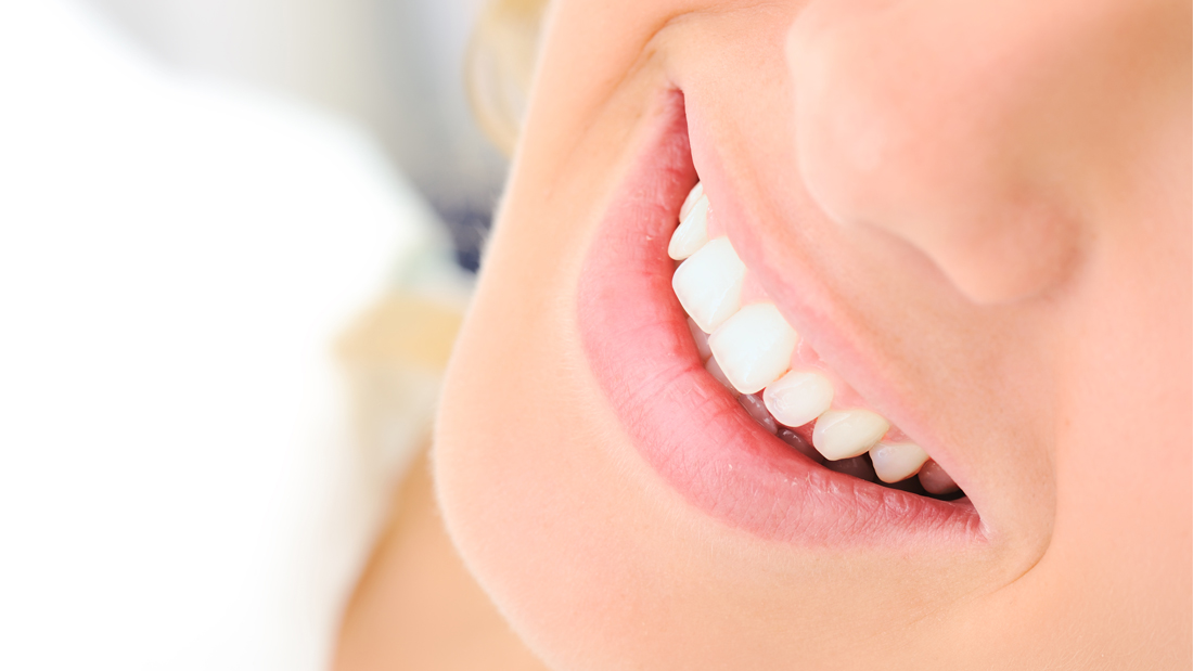 マウスピース矯正インビザライン
