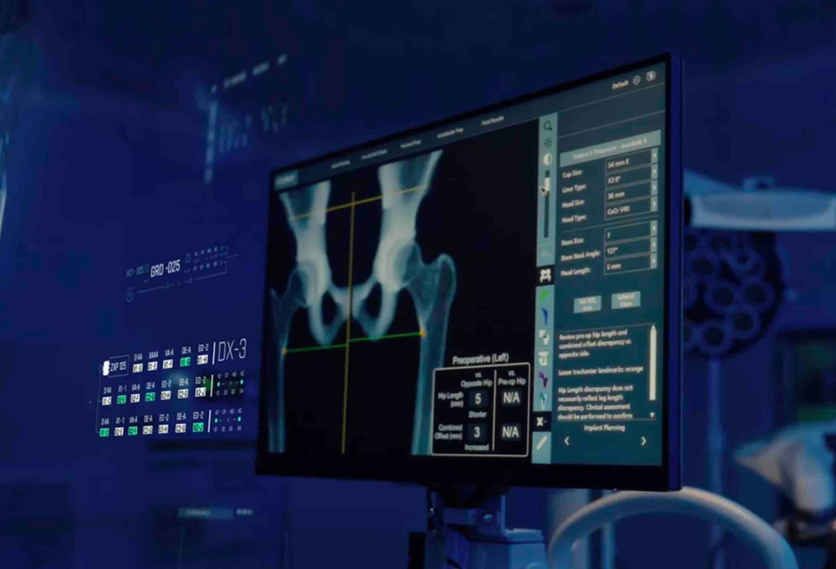 Tecnología Háptica AccuStop™