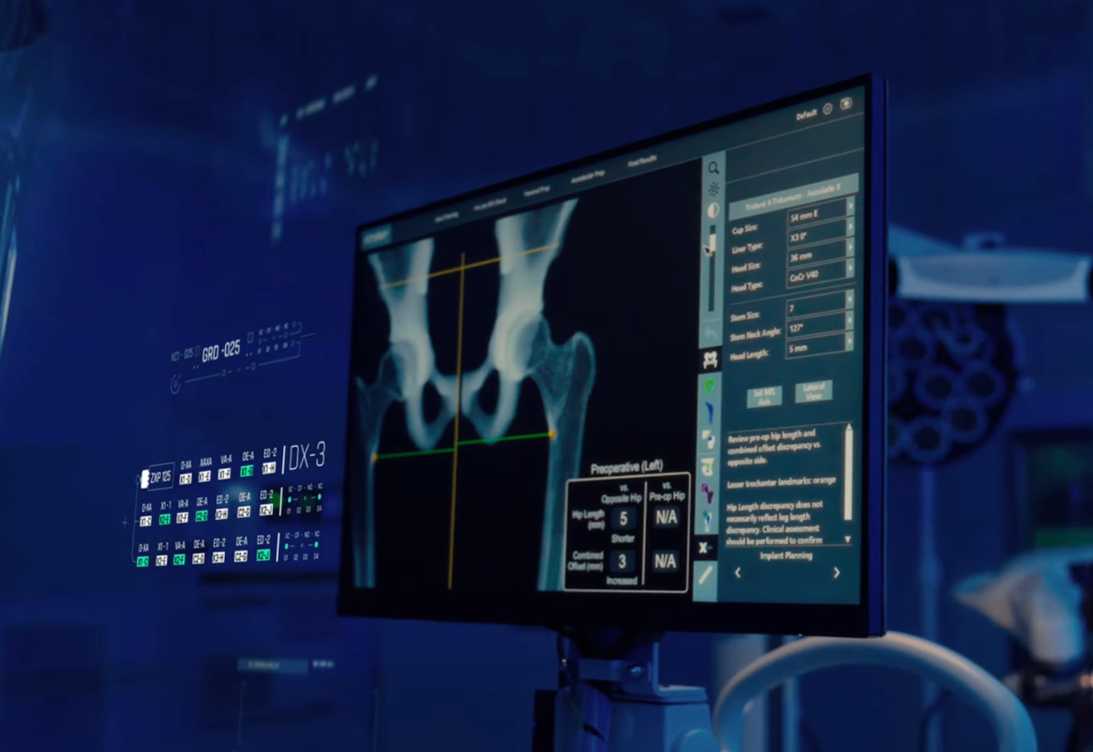 Tecnología háptica AccuStop Mako SmartRobotics para cirugía robótica segura de cadera rodilla artrosis