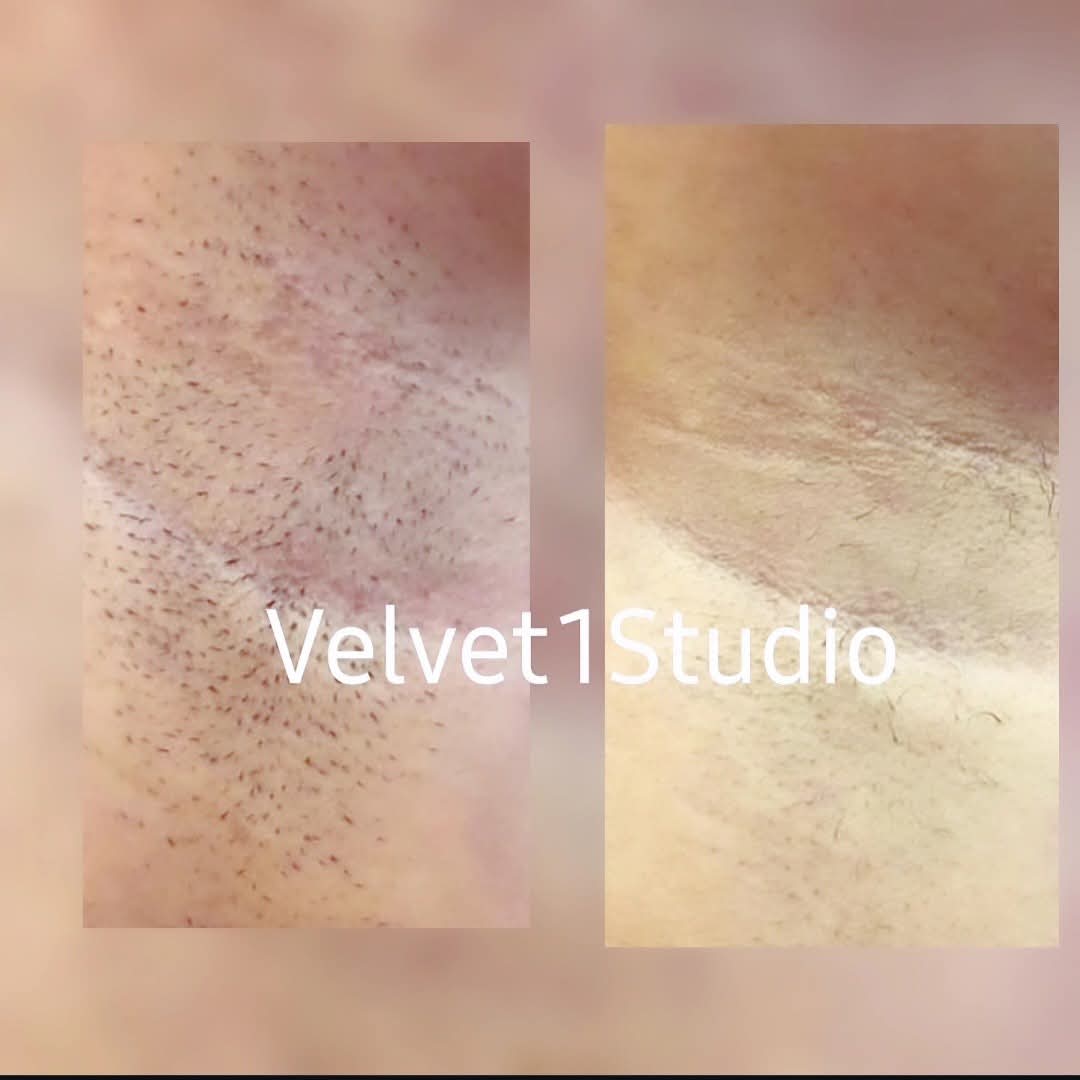 Rezultat procedură 4