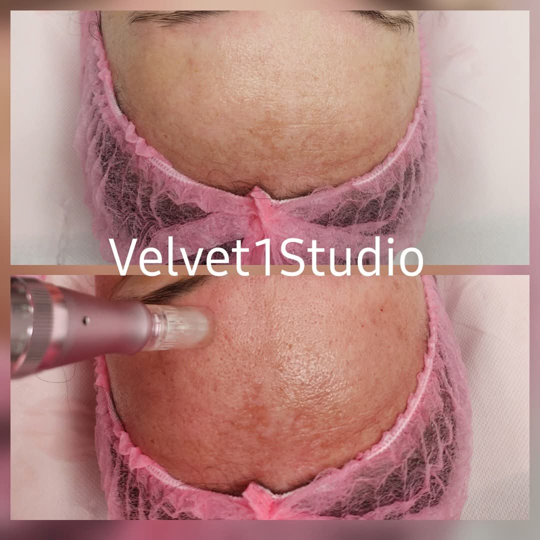 Rezultat procedură 2