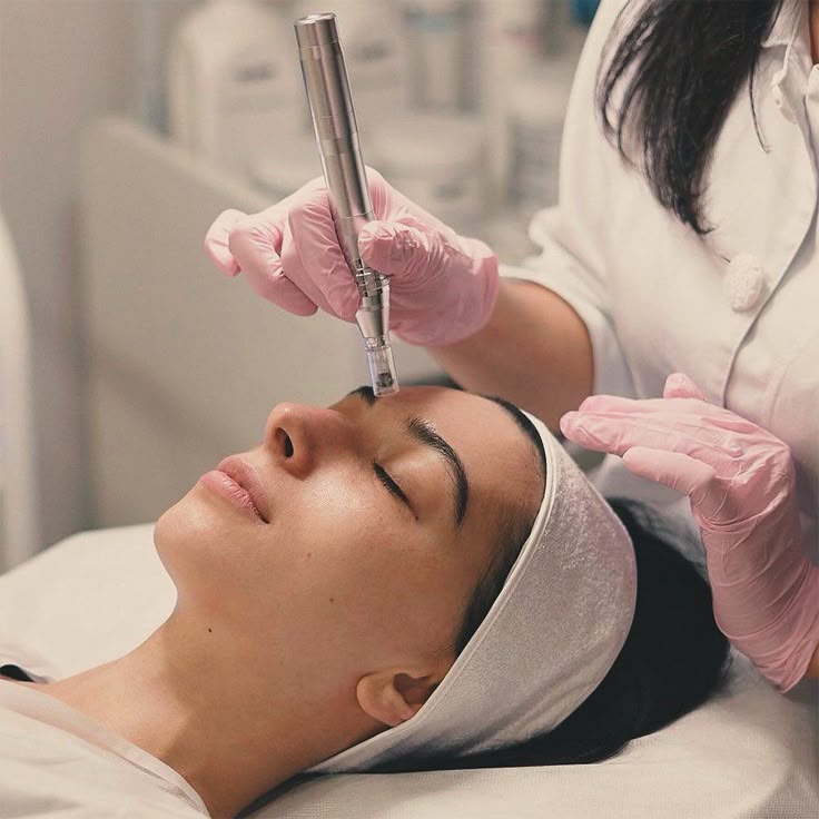 Microneedling