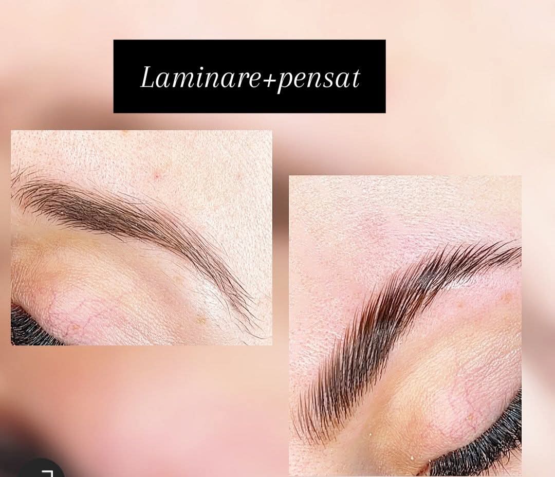 Rezultat procedură 7