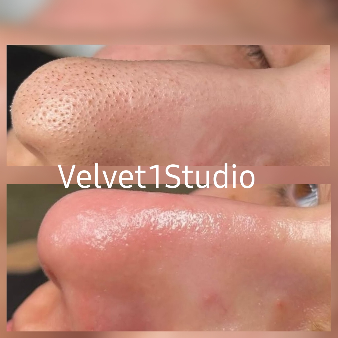 Rezultat procedură 11