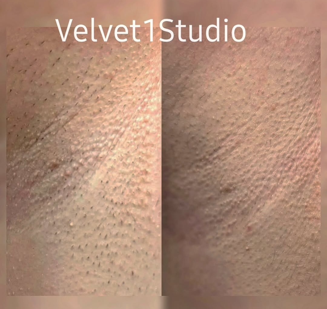 Rezultat procedură 8