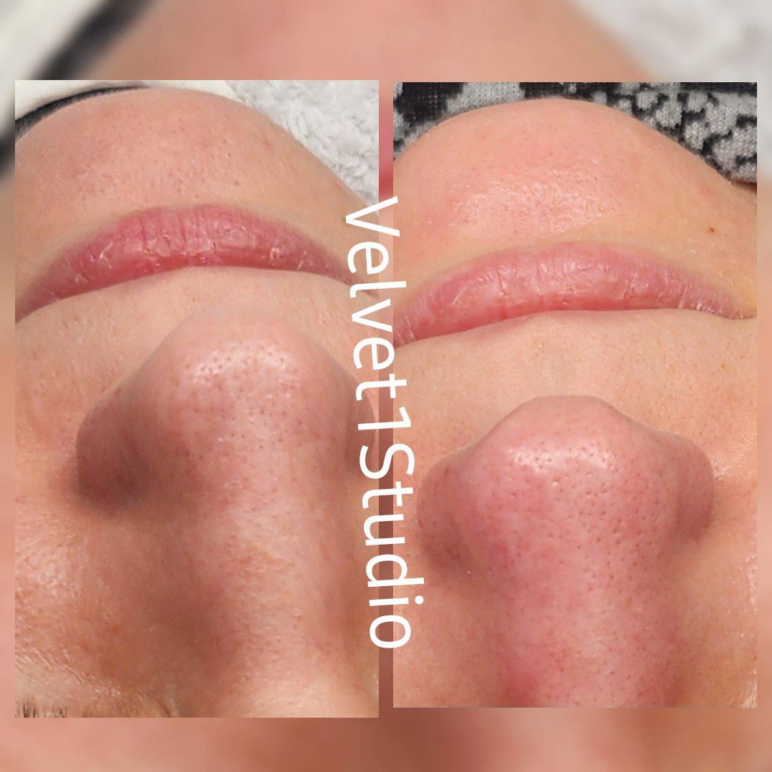 Rezultat procedură 12