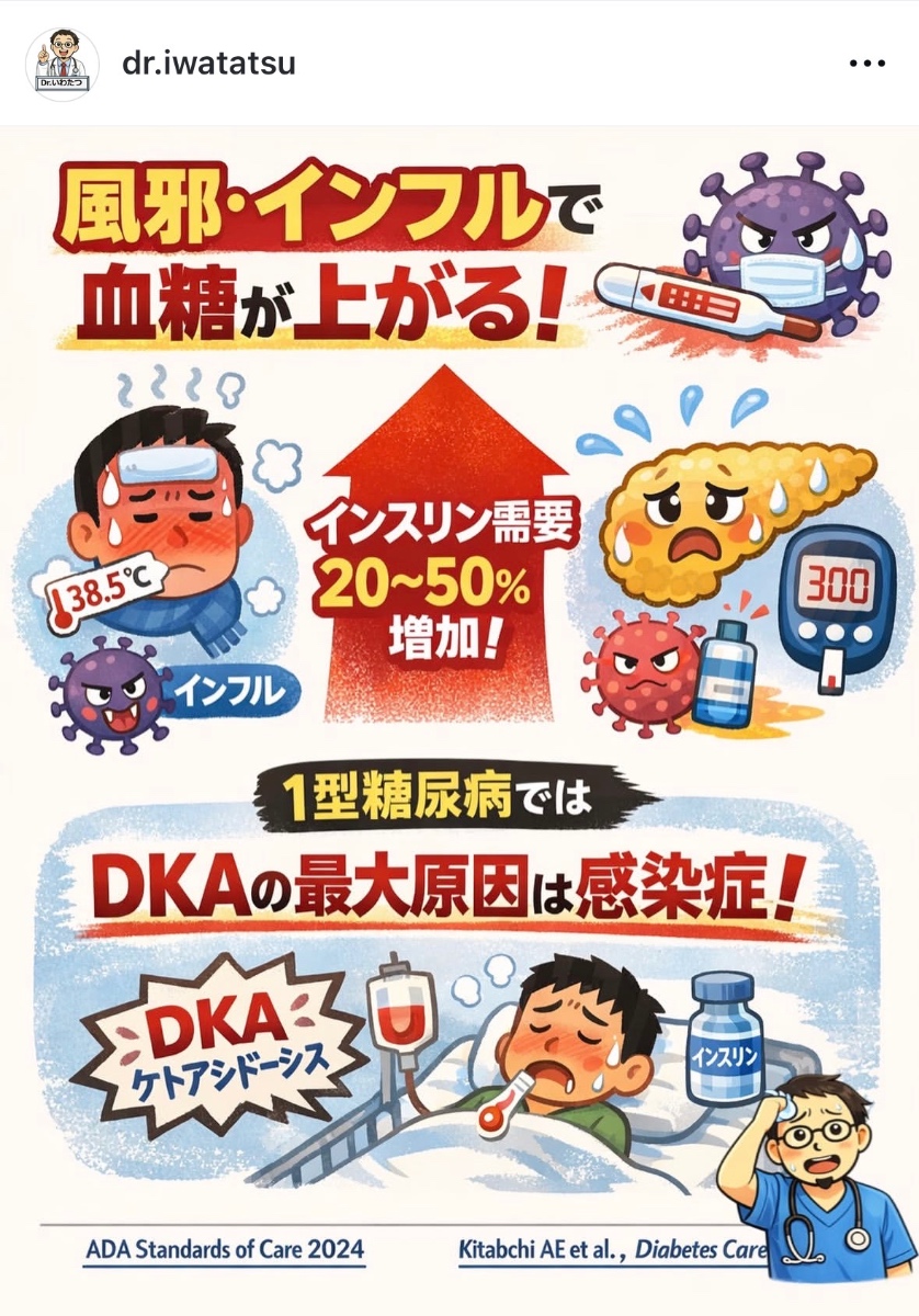 風邪・インフルエンザと血糖上昇,1型糖尿病のDKA