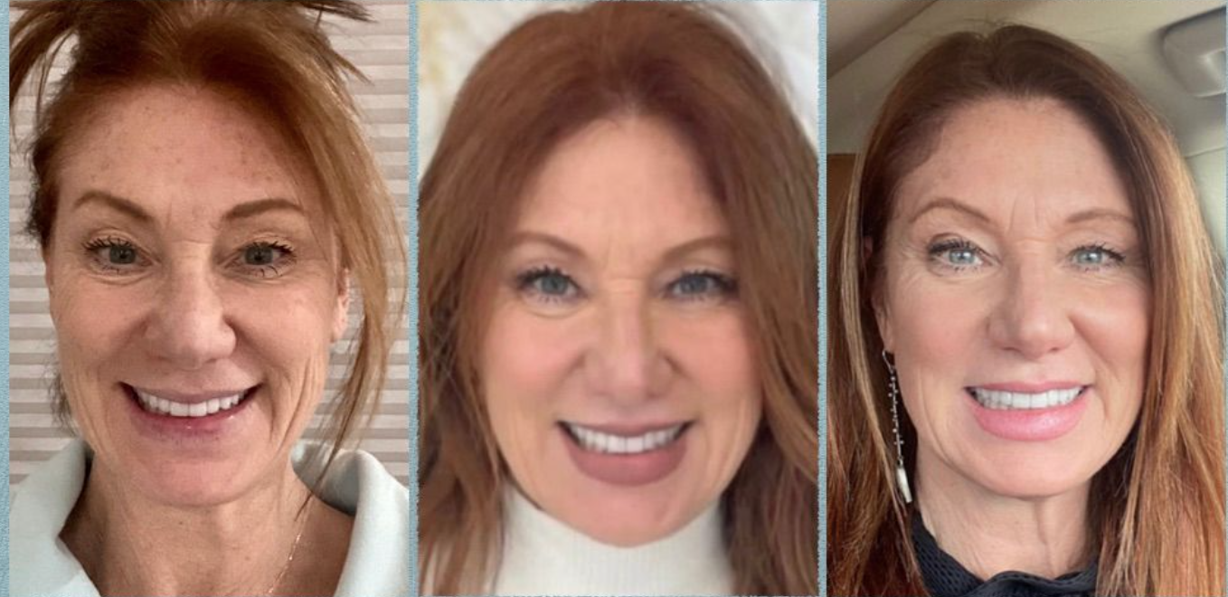 Airway Facial Epigenetics Did This