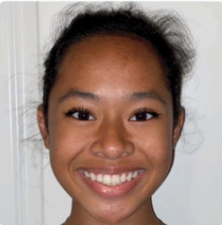 Zion's transformation