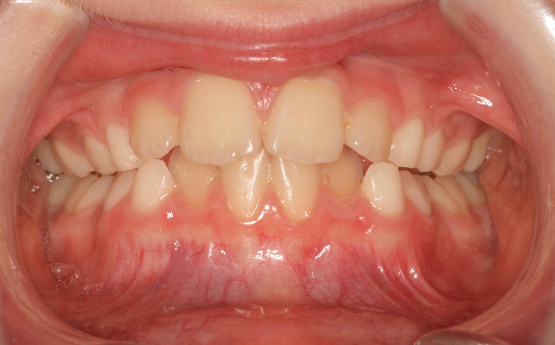 Epigenetics smile result