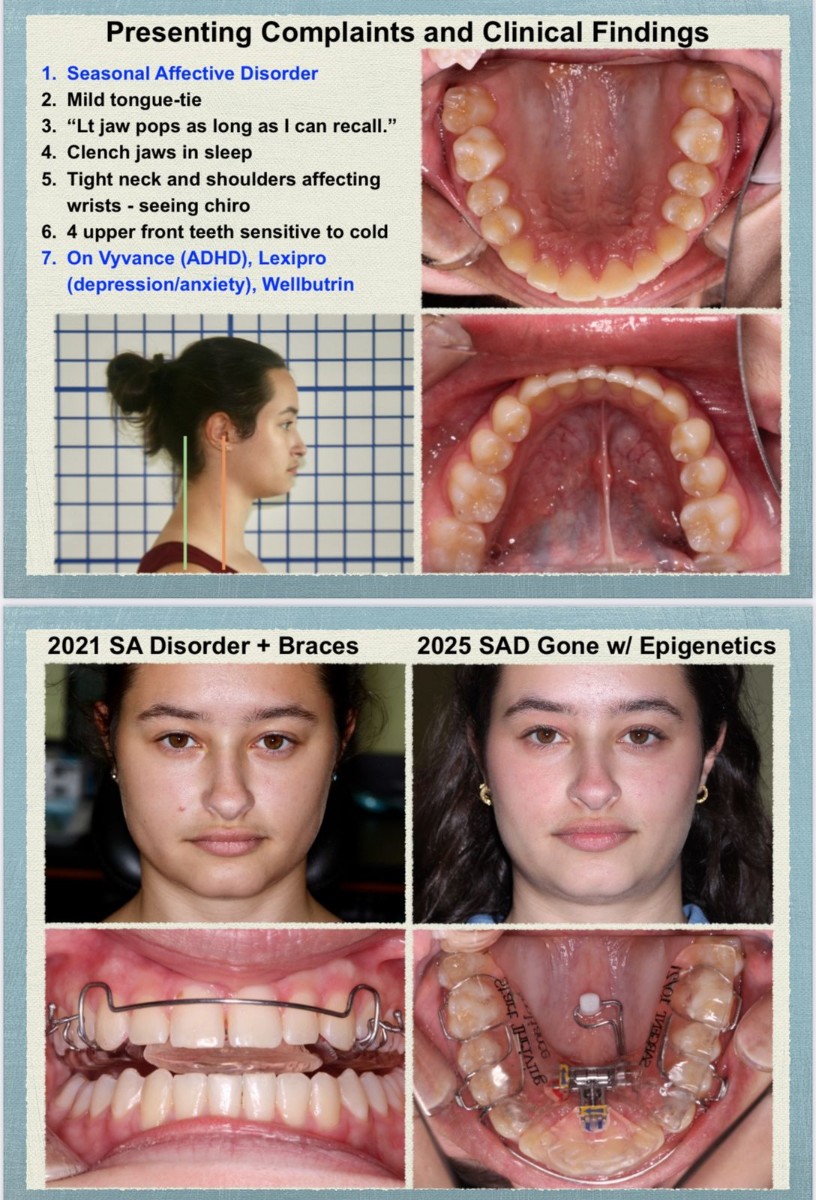 After treatment — 2025