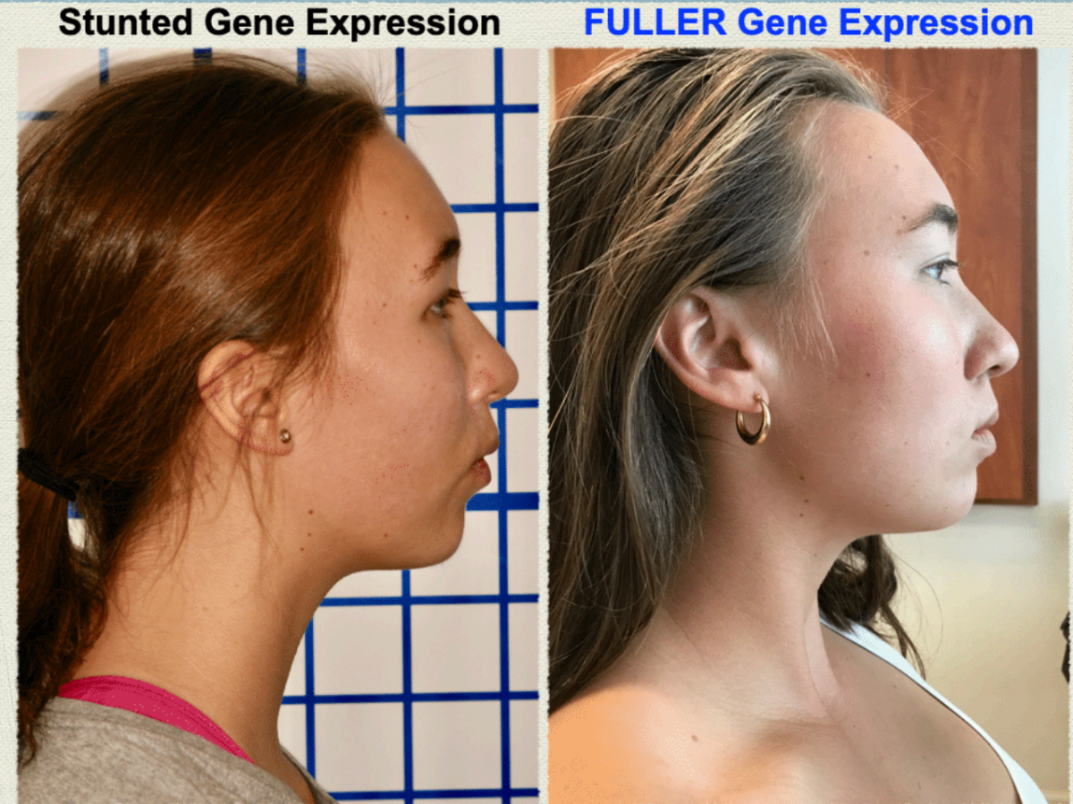 Stunning transformation - Stunted Gene Expression to Fuller Gene Expression
