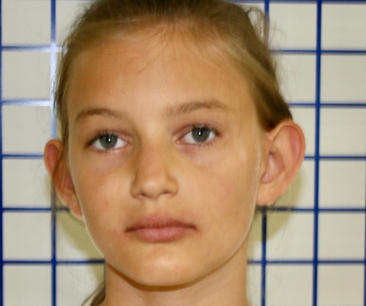 Before treatment - natural state