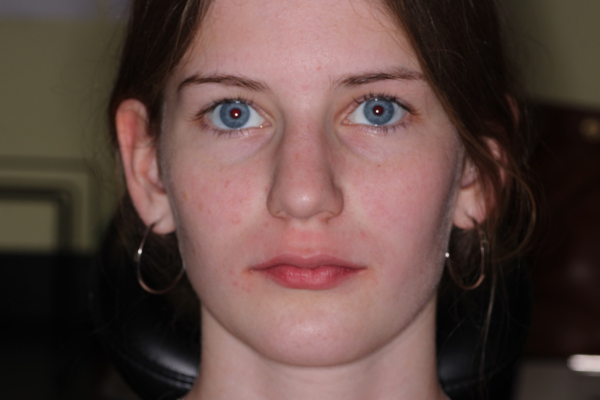 Additional epigenetics case documentation