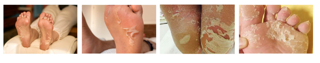 Foot Peeling Pack Details