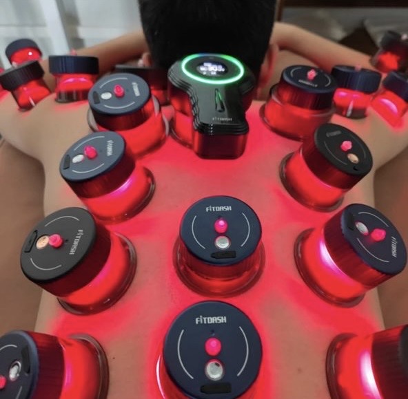 Cupping & Integrative Modalities